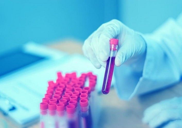 Image: New Alzheimer’s studies have revealed disease biology, risk for progression, and potential for a novel blood test (Photo courtesy of Adobe Stock)